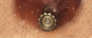 Roto-Jiggler Vibrating nozzle  in pipe